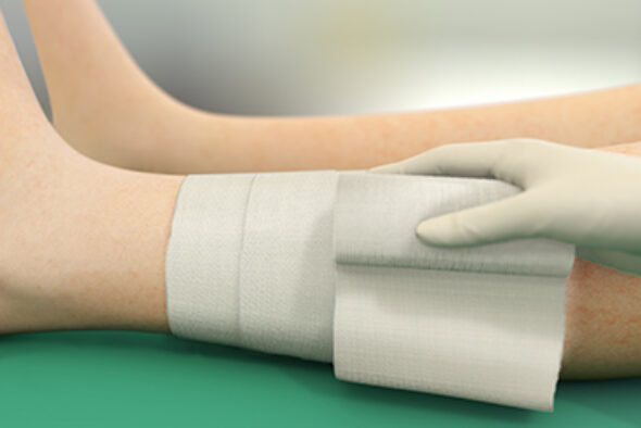 Henkilö kiinnittää Sorbact Absorption -sidoksen kiinnityssiteellä jalan ympärille.