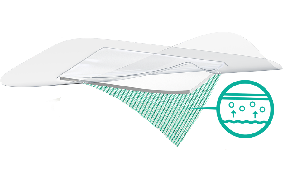 Kuvitus Sorbact-sidoksen kerroksesta ja siitä, kuinka bakteerit sitoutuvat sidoksen vihreään pintaan.