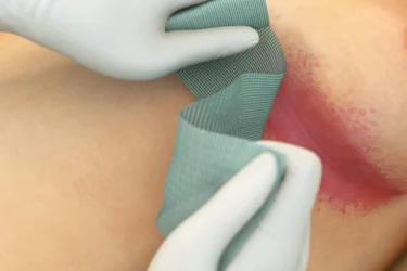 Henkilö asettaa Sorbact Fungi -sidoksen tulehtuneelle alueelle rinnan alle.