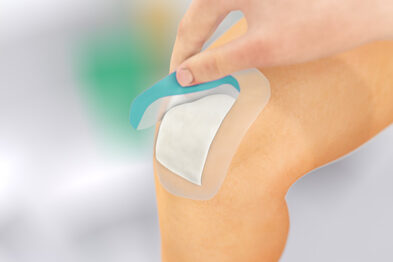 Henkilö poistaa suojakalvon Sorbact Secure -sidoksesta polvessa.